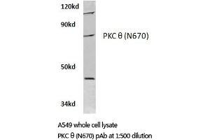 Western blot (WB) analyzes of PKC ζ antibody in extracts from A549 cells. (PKC theta antibody)