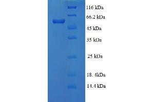 SDS-PAGE (SDS) image for Lysyl Oxidase-Like 1 (LOXL1) (AA 106-574), (partial) protein (His tag) (ABIN4976549)