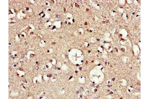 Immunohistochemistry of paraffin-embedded human brain tissue using ABIN7144390 at dilution of 1:100 (AAK1 antibody  (AA 274-465))
