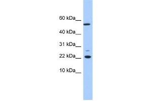 DPH4 antibody used at 1 ug/ml to detect target protein. (DNAJC24 antibody  (N-Term))
