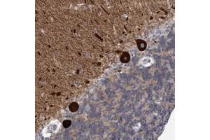 Immunohistochemical staining of human cerebellum with KCTD8 polyclonal antibody  shows strong cytoplasmic positivity in Purkinje cells at 1:20-1:50 dilution.