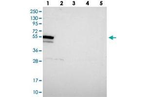 Western blot analysis of Lane 1: RT-4, Lane 2: U-251 MG, Lane 3: Human Plasma, Lane 4: Liver, Lane 5: Tonsil with DHX34 polyclonal antibody . (DHX34 antibody)