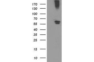 Western Blotting (WB) image for anti-Cytochrome P450, Family 2, Subfamily J, Polypeptide 2 (CYP2J2) antibody (ABIN1497731) (CYP2J2 antibody)