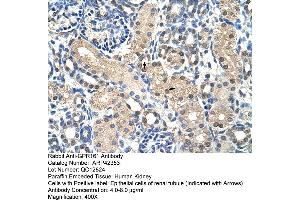 Rabbit Anti-GPR161 Antibody  Paraffin Embedded Tissue: Human Kidney Cellular Data: Epithelial cells of renal tubule Antibody Concentration: 4.