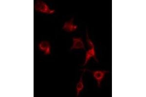 ABIN6275608 staining HT29 by IF/ICC. (SFRS7 antibody  (Internal Region))