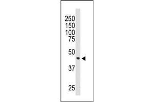 Western blot analysis of anti-DOK2 Pab (ABIN392072 and ABIN2841834) in 174xCEM cell lysate. (DOK2 antibody  (C-Term))