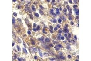 Immunohistochemistry of Bonzo in human spleen cells with Bonzo antibody at 20 μg/ml. (CXCR6 antibody  (N-Term))