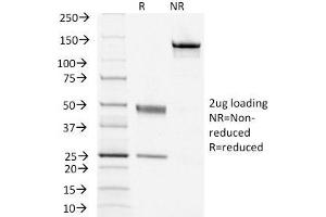 SDS-PAGE Analysis Purified TSHRB Monoclonal Antibody (TSHRB/1405). (TSH receptor antibody)