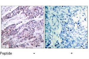Image no. 1 for anti-B-Cell CLL/lymphoma 2 (BCL2) (AA 54-58) antibody (ABIN197203) (Bcl-2 antibody  (AA 54-58))