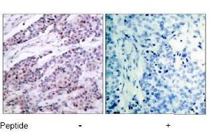 Image no. 1 for anti-B-Cell CLL/lymphoma 2 (BCL2) (AA 54-58) antibody (ABIN197202) (Bcl-2 antibody  (AA 54-58))