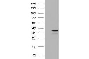 Western Blotting (WB) image for anti-E3 SUMO-Protein Ligase NSE2 (NSMCE2) antibody (ABIN1499526) (NSMCE2 antibody)