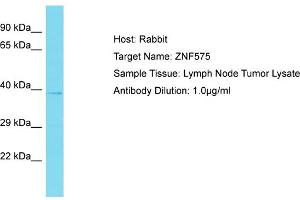 Host: Rabbit Target Name: ZNF575 Sample Tissue: Human Lymph Node Tumor Antibody Dilution: 1ug/ml (ZNF575 antibody  (Middle Region))