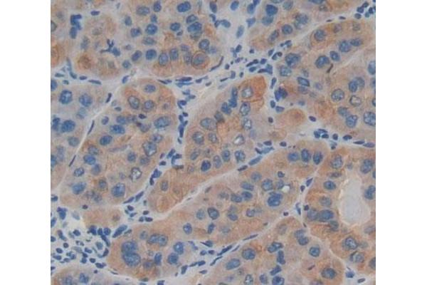 LAMb4 antibody  (AA 1543-1759)