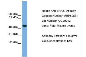 WB Suggested Anti-BRF2  Antibody Titration: 0.
