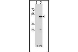 Western blot analysis of RBM22 (arrow) usingRBM22 Antibody . (RBM22 antibody  (Middle Region))