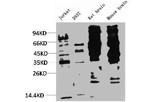Western blot analysis of 1) Jurkat, 2) 293T, 3) Rat Brain Tissue, 4) Mouse Brain Tissue with Phosphotyrosine Mouse mAb diluted at 1:2,000. (Phosphotyrosine antibody)
