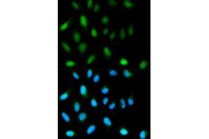 Immunofluorescence analysis of HeLa cells using CBX5 antibody.