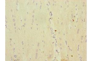 Immunohistochemistry of paraffin-embedded human heart tissue using ABIN7142250 at dilution of 1:100 (MRPS16 antibody  (AA 1-137))