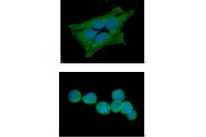 ICC/IF analysis of GSS in HeLa cells line, stained with DAPI (Blue) for nucleus staining and monoclonal anti-human GSS antibody (1:100) with goat anti-mouse IgG-Alexa fluor 488 conjugate (Green). (Glutathione Synthetase antibody  (AA 1-474))
