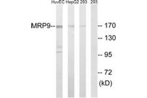 Western Blotting (WB) image for anti-ATP-Binding Cassette, Sub-Family C (CFTR/MRP), Member 12 (ABCC12) (AA 691-740) antibody (ABIN2890422) (ABCC12 antibody  (AA 691-740))