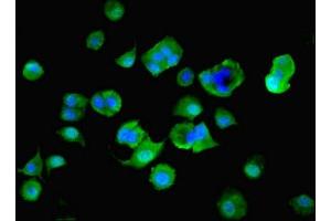 Immunofluorescent analysis of MCF-7 cells using ABIN7142610 at dilution of 1:100 and Alexa Fluor 488-congugated AffiniPure Goat Anti-Rabbit IgG(H+L) (MTHFS antibody  (AA 2-203))