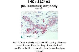 Image no. 1 for anti-Solute Carrier Family 4, Anion Exchanger, Member 2 (erythrocyte Membrane Protein Band 3-Like 1) (SLC4A2) (N-Term) antibody (ABIN1739387)