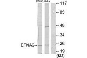 Western blot analysis of extracts from HeLa/COLO205 cells, using EFNA2 Antibody. (Ephrin A2 antibody  (AA 1-50))