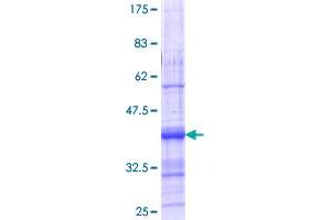 ACVR1C/ALK7 Protein (AA 23-112) (GST tag)