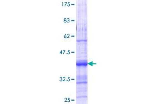 ACVR1C/ALK7 Protein (AA 23-112) (GST tag)