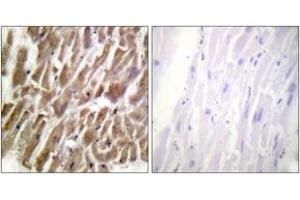 Immunohistochemistry (IHC) image for anti-Cardiac Troponin I (TNNI3) (AA 11-60) antibody (ABIN2888778) (TNNI3 antibody  (AA 11-60))