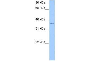Western Blot showing hCG_1982709 antibody used at a concentration of 1-2 ug/ml to detect its target protein. (hCG_1982709 (N-Term) antibody)