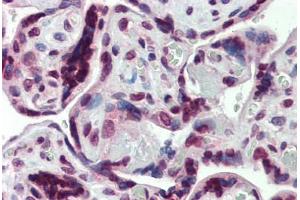 Human Placenta: Formalin-Fixed, Paraffin-Embedded (FFPE) (SHROOM2 antibody  (AA 1554-1616))