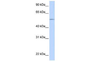 UGT1A1 antibody used at 1 ug/ml to detect target protein. (UGT1A1 antibody  (N-Term))