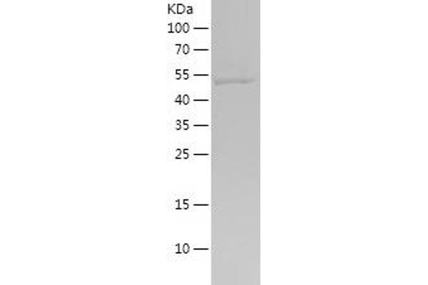 Glutathione Reductase Protein (GSR) (AA 273-522) (His-IF2DI Tag)