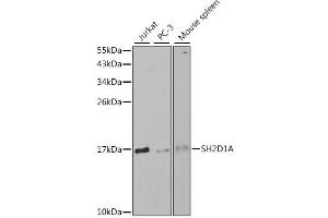 Western blot analysis of extracts of various cell lines, using SH2D1A antibody. (SH2D1A antibody)