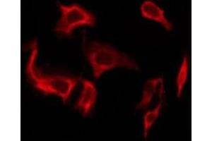 ABIN6276238 staining A549 by IF/ICC. (GIPR antibody  (Internal Region))