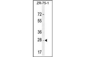 Western blot analysis of NDUFAF1 Antibody (C-term) in ZR-75-1 cell line lysates (35ug/lane). (NDUFAF1 antibody  (C-Term))
