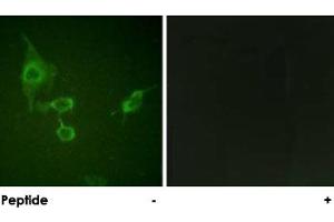 Immunofluorescence analysis of HepG2 cells, using HCK polyclonal antibody . (HCK antibody)