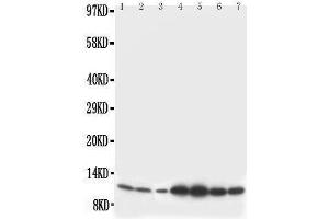 Anti-S100 beta antibody, Western blotting Lane 1: Rat Brain Tissue Lysate Lane 2: Rat Brain Tissue Lysate Lane 3: MCF-7 Cell Lysate Lane 4: HELA Cell Lysate Lane 5: SMMC Cell Lysate Lane 6: JURKAT Cell Lysate Lane 7: COLO320 Cell Lysate (S100B antibody  (C-Term))