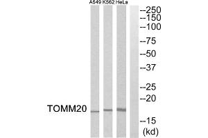 Western blot analysis of extracts from HeLa cells, K562 cells and A549 cells, using TOMM20 antibody. (TOMM20 antibody  (Internal Region))