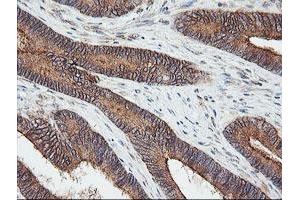 Image no. 1 for anti-Ubiquitin-Conjugating Enzyme E2G 2 (UBE2G2) antibody (ABIN1501630) (UBE2G2 antibody)
