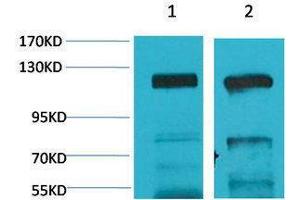 Western Blotting (WB) image for anti-Glutamate Receptor, Ionotropic, AMPA 4 (GRIA4) antibody (ABIN3181532) (GRIA4 antibody)