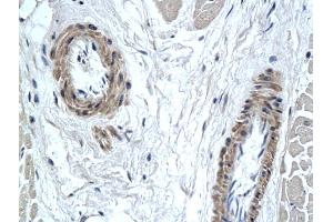 Formalin-fixed and paraffin embedded human heart tissue labeled with Anti-PAX7 Polyclonal Antibody, Unconjugated (ABIN739905) followed by conjugation to the secondary antibody (PAX7 antibody  (AA 410-460))