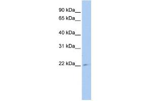WB Suggested Anti-TUSC1 Antibody Titration: 0. (TUSC1 antibody  (Middle Region))