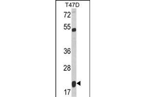Western blot analysis of SC Antibody (C-term) (ABIN6243156 and ABIN6578976) in T47D cell line lysates (35 μg/lane).