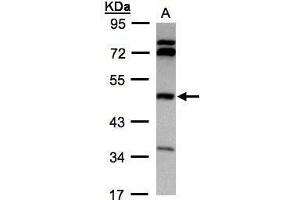 WB Image Sample(30 ug whole cell lysate) A:Hep G2 , 10% SDS PAGE antibody diluted at 1:1000 (BHMT antibody)