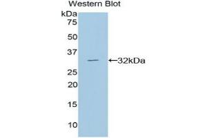 Detection of DGKa in Recombinant Diacylglycerol Kinase Alpha, Rat using Polyclonal Antibody to Diacylglycerol Kinase Alpha (DGKa) (DGKA antibody  (AA 312-557))