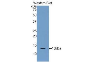 Western Blotting (WB) image for anti-Gap Junction Protein, beta 3, 31kDa (GJB3) (AA 7-102) antibody (ABIN1858572) (Connexin 31 antibody  (AA 7-102))