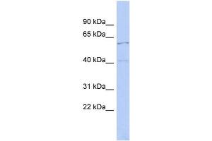 WB Suggested Anti-ZNF384 Antibody Titration: 0. (ZNF384 antibody  (Middle Region))