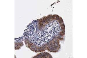 Immunohistochemical staining (Formalin-fixed paraffin-embedded sections) of human fallopian tube shows membranous and cytoplasmic positivity in glandular cells with CRKL polyclonal antibody . (CrkL antibody  (AA 125-301))